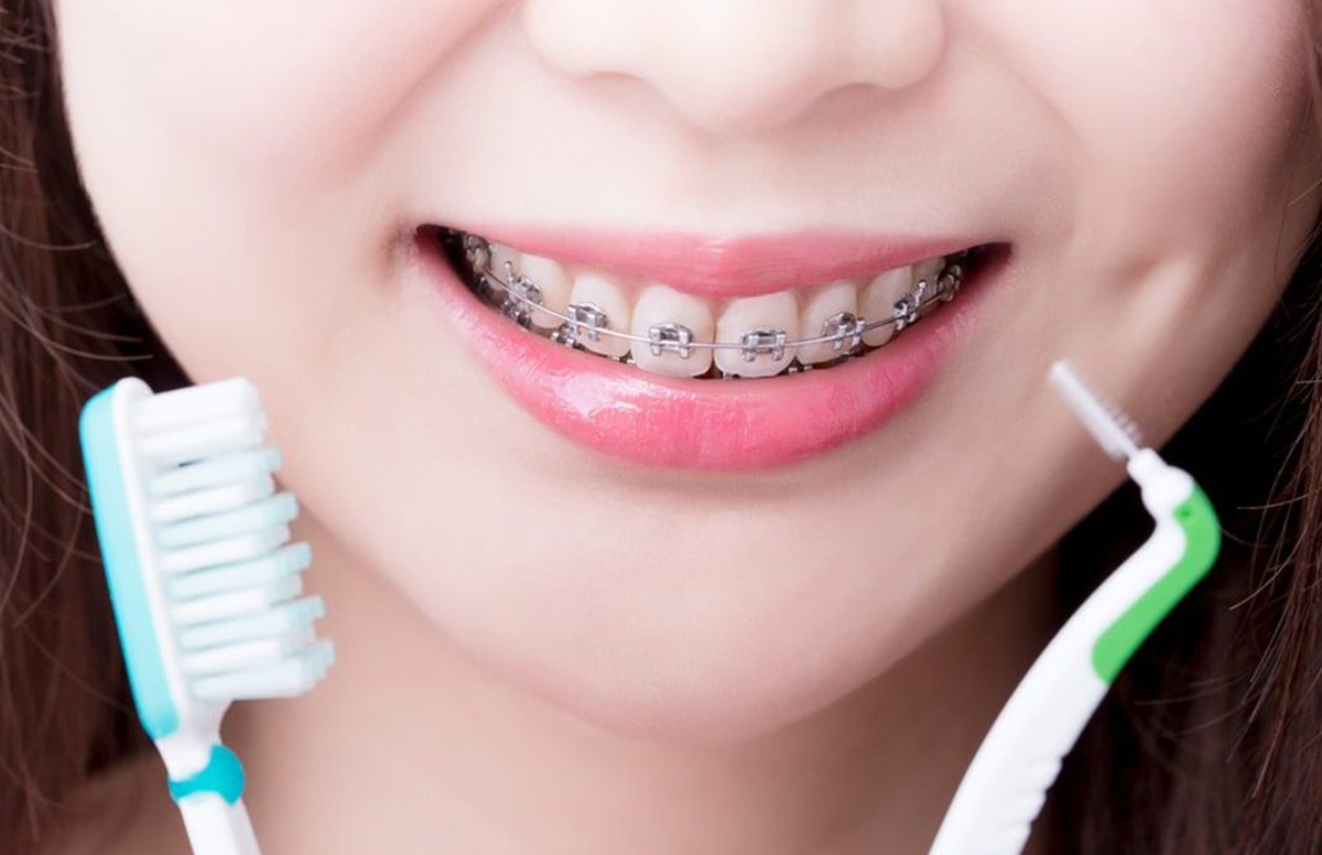 Cepillo de dientes: consejos para mantenerlo en buen estado